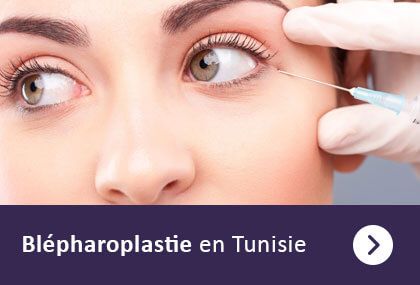 Chirurgie visage Tunisie - tarifs tout compris - qualité et sécurité