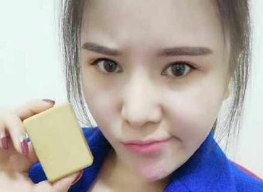 Insolite : Une jeune femme envoie à son ex un savon fait de graisse issue de sa liposuccion