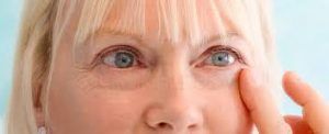 Blepharoplastie Tunisie : Prix chirurgie paupières pas cher, devis gratuit