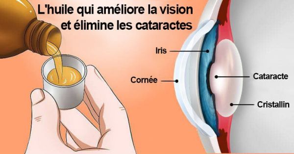 L’huile qui améliore la vision et élimine les cataractes (comment l’utiliser)