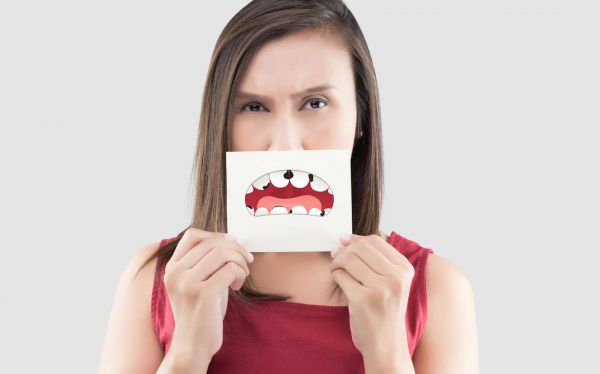 Caries : et si notre système immunitaire était responsable de leur apparition ?