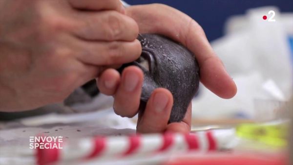 VIDEO. Quand Prisca, mutilée après un cancer de l'œil, découvre la prothèse qui va lui offrir un nouveau visage