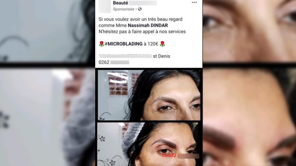 (Pierrot Dupuy) Quand Nassimah se met en scène en train de se faire refaire les sourcils...