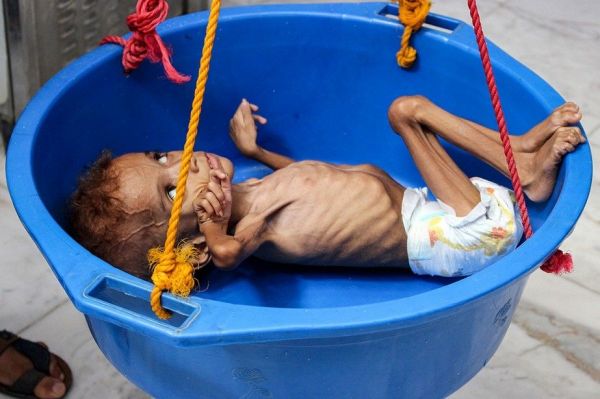 Des millions de personnes risquent de mourir de faim au Yémen après que les Saoudiens et les Émirats arabes unis n'aient pas tenu leur promesse de dons (Middle East Monitor)