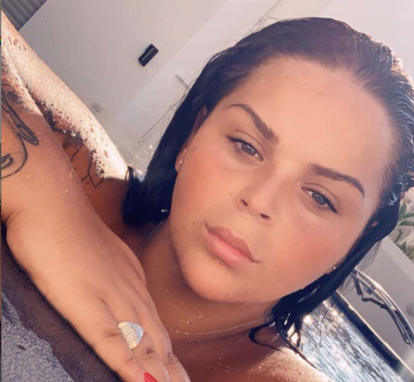 Sarah Fraisou succombe une nouvelle fois à la chirurgie esthétique