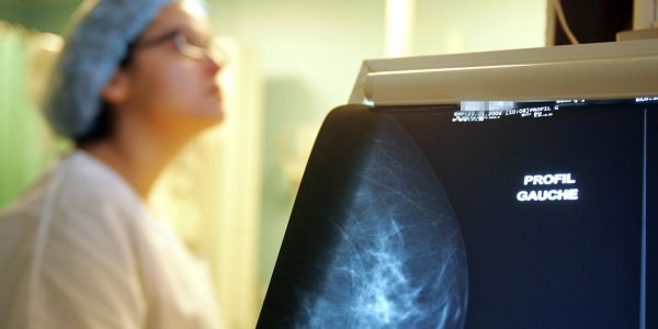 Octobre Rose : après un cancer du sein, quelles sont les techniques de reconstruction existantes ?