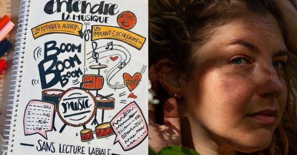 Surdité : porteuse d’un implant cochléaire, elle dessine son handicap