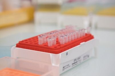 Cancer de la prostate : bientôt un test à domicile ?
