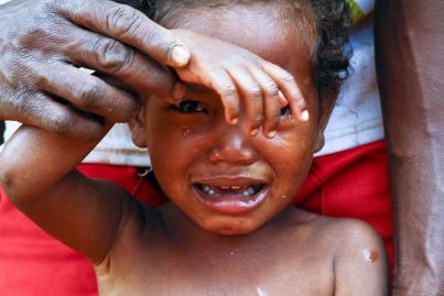Rougeole : une terrible épidémie en République démocratique du Congo