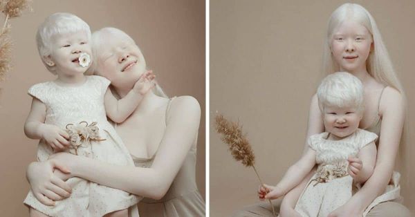 Ces deux sœurs kazakhes sont nées albinos à treize ans d’écart