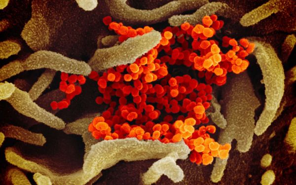Des images inédites du nouveau coronavirus Sars-CoV-2