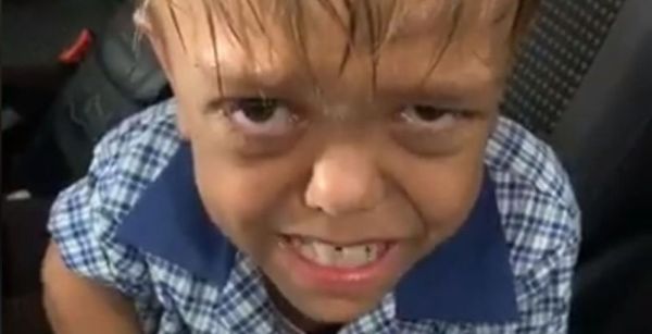 « Je veux me suicider » : le cri de douleur de Quaden, enfant atteint de nanisme et harcelé