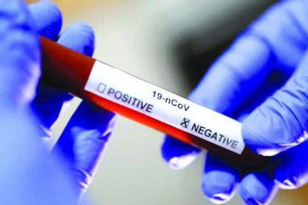 2 nouveaux déces liés au COVID 19 en Guadeloupe, 106 cas confirmés