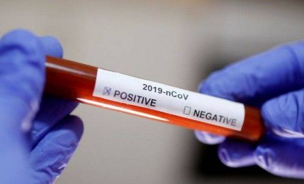 LIVE. Covid-19 : 1 456 cas confirmés en Outre-mer, Mayotte passe au stade 3 de l’épidémie