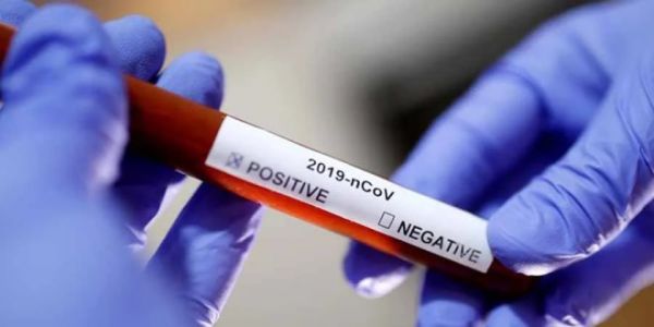 Covid-19 : La RDC enregistre 59 nouveaux cas confirmés