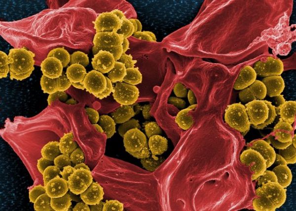 Quand une recette médiévale vieille de 1000 ans vient à bout d’un film antibiorésistant
