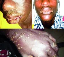 Maladie mystérieuse chez les pécheurs de Thiaroye – Hebdomadaire Révélations