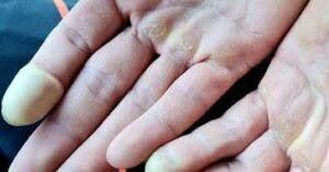 Moins 25 degrés, engelures : quand les fondeurs souffrent du très grand froid en Suisse
