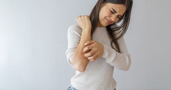Comment calmer les démangeaisons ?