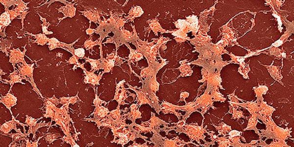Dans « Le Peuple microbien », l'infiniment petit examiné à la loupe du biologiste Laurent Palka