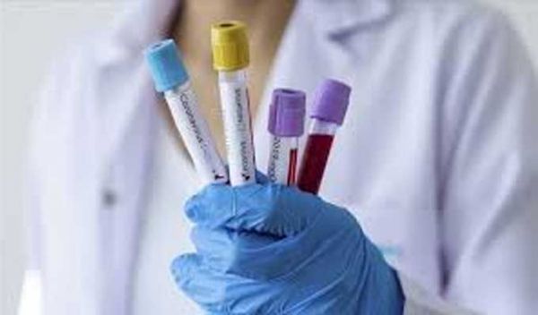 Béja-covid19: 4 décès et 15 nouvelles contaminations
