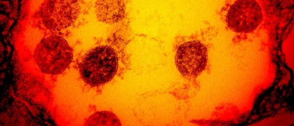 EN DIRECT - Coronavirus - Il n'y aura pas de confinement le week-end à Paris et dans 7 autres départements en Ile-de-France - Seuls un ou deux départements supplémentaires en France seraient [...]