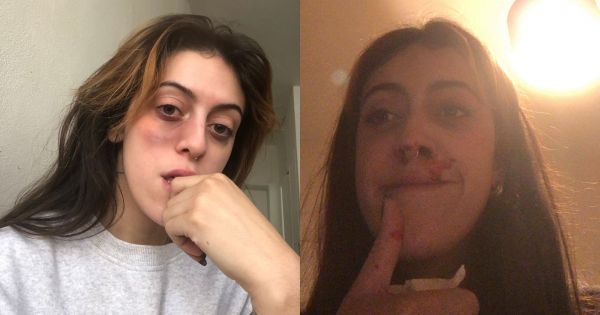 « Éduquez vos fils » : après une agression devant chez elle, elle publie un message fort sur Twitter