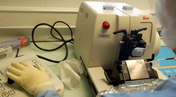 Toulouse : Un agent retraité meurt de la « maladie de la vache folle » après avoir travaillé en laboratoire sur les prions