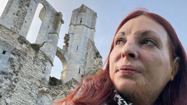 «Une page se tourne, mais oublier, je ne pourrai jamais» : pour Emilie, brûlée vive, enfin la délivrance