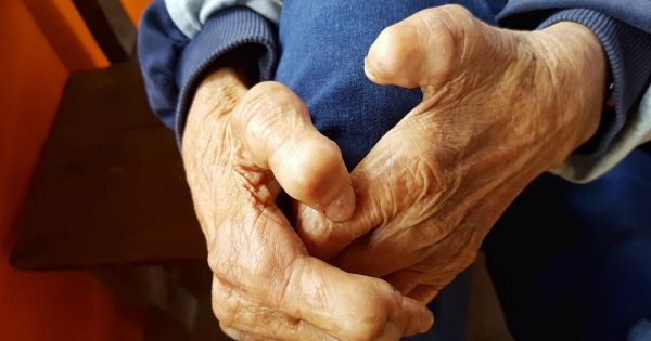 Journée mondiale. Lèpre : une question de temps