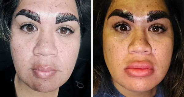 Une femme sous le choc après une séance de microblading des sourcils qui a mal tourné