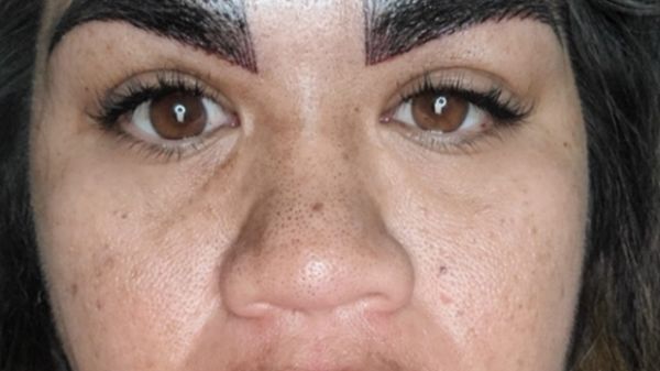 "C'est horrible!": Le nouveau visage de cette femme après un microblading qui tourne mal