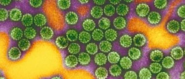 Variole du singe: Un premier cas d'infection confirmé en France, annonce la Direction générale de la Santé - Il a été détecté en Ile-de-France chez un homme de 29 ans sans antécédent [...]