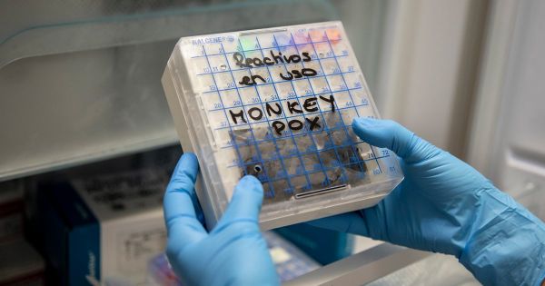 La variole du singe provoque des symptômes différents chez les Européens