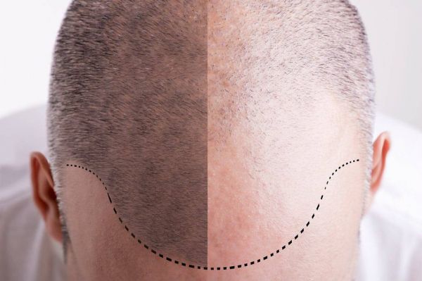 Quelle est la différence entre Dermopigmentation, Microblading, Maquillage Permanent et Semi Permanent ?