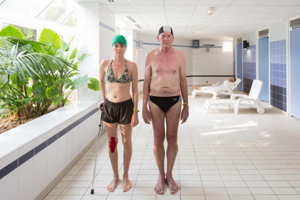 Covid long : des troubles peu spécifiques au centre de vifs débats