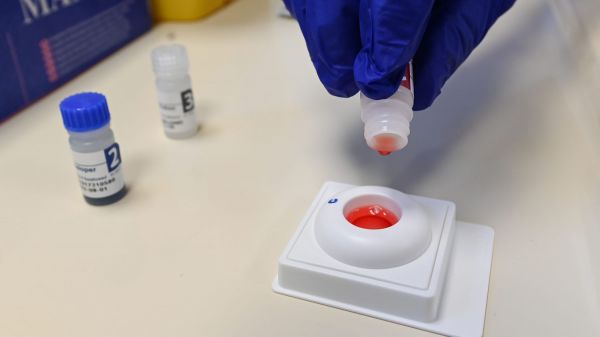 VIH : "Aller se faire dépister, c'est rester en bonne santé", alerte la directrice générale de Sidaction