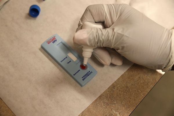 Sida : le dépistage du VIH repart à la hausse en 2021, mais reste inférieur au niveau pré-pandémie