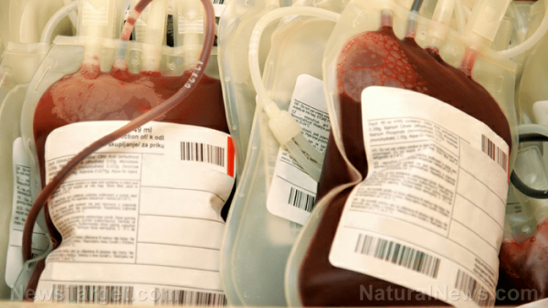 Transfusions/SafeBlood Donation : augmentation des banques de « sang non-vacciné »