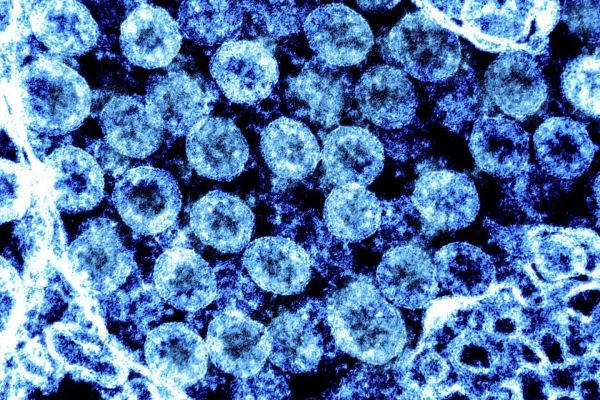 La souche Omicron s'est probablement développée en Afrique de l'Ouest, selon une étude parue dans « Science »