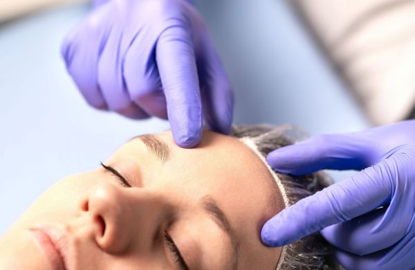 La chirurgie de réduction du front : la nouvelle obsession des réseaux sociaux