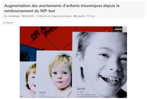 Hypocrisie : Mattel sort un modèle « inclusif » de poupée Barbie trisomique !