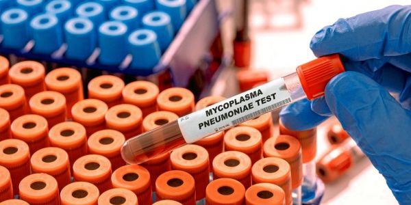 Mycoplasma pneumoniae, ce qu'il faut savoir sur cette bactérie