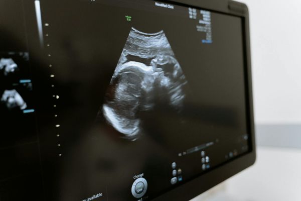 En Corée du Sud, un embryon partie civile dans un procès d'enfants pour inaction climatique