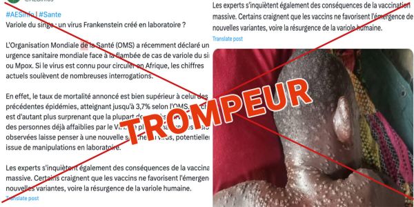 Virus Mpox : une nouvelle souche créée en laboratoire ?