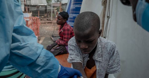 Epidémie de Mpox : les vraies raisons de s'inquiéter, par le Pr Gilles Pialoux