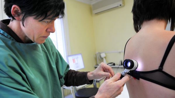 Cancer de la peau: grains de beauté, taches brunes... ces cinq signes et facteurs de risque à surveiller