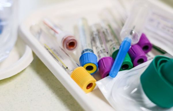 Santé : « Le seul cas connu au monde »... Un nouveau groupe sanguin « Gwada négatif » découvert