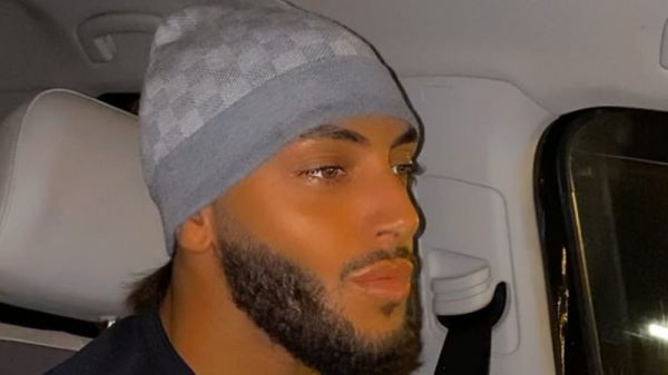 TikTok banni l'influenceur Amine Mijoto, après ses vidéos de "fausses attaques de piqûres"