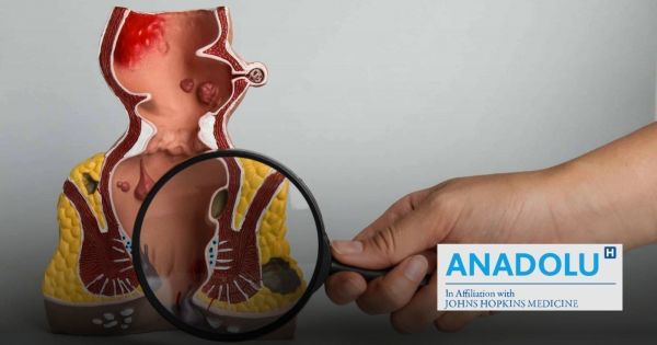 Démystifier les fissures anales : signes révélateurs et traitement efficaces
